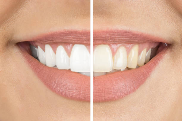 3 Cosmetic Dentistry Tips for an Aesthetic Smile