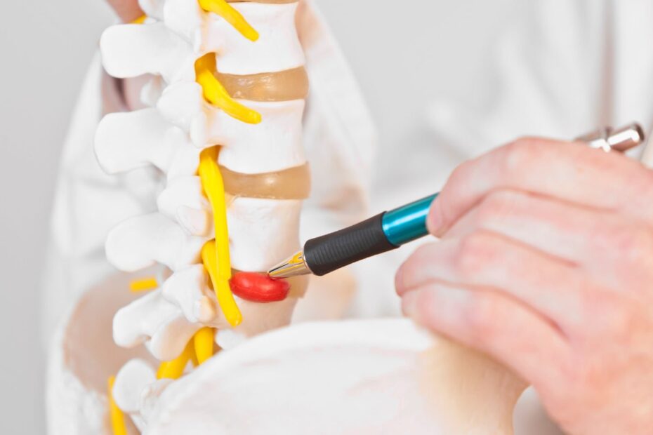 Can a Herniated Disc Heal on Its Own?