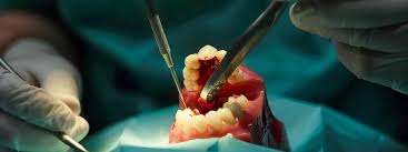 How Dentists Handle Unexpected Tooth Problems