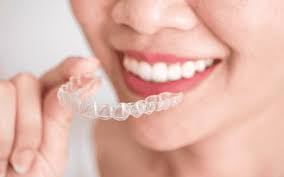 How Invisalign Aligns Teeth Without Traditional Braces