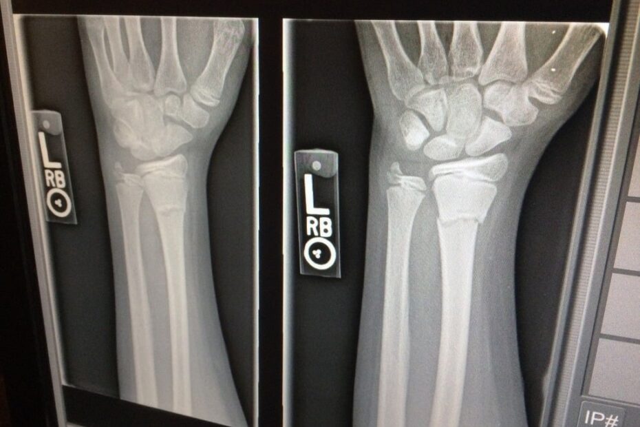 MRI vs. X-Ray: Choosing the Right Imaging for Your Condition