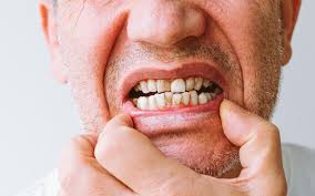 The Connection Between Oral Health and Overall Health