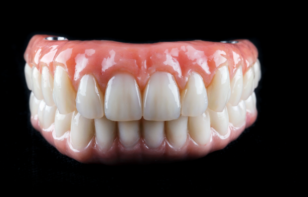 Exploring the Lifespan of Dental Implants: How Long Do They Really Last?