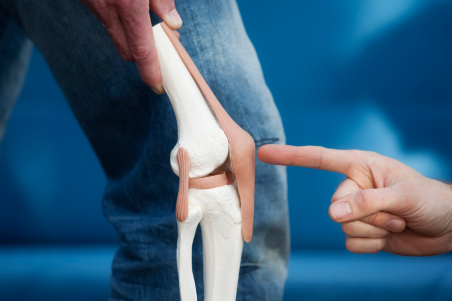 What Is Genicular Artery Embolization for Knee Pain?