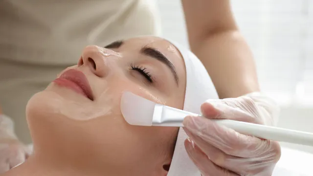 Chemical Peels for Acne